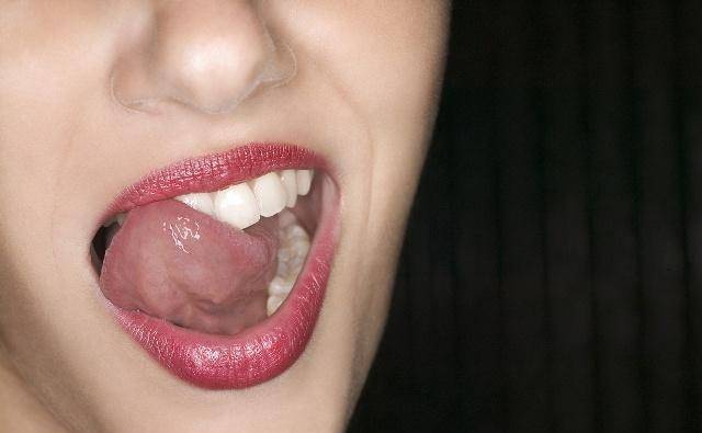 那么,舌癌早期,一般会有哪些异常症状呢?