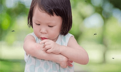 痒痒痒！孩子被蚊虫叮咬后,这样止痒最有效！