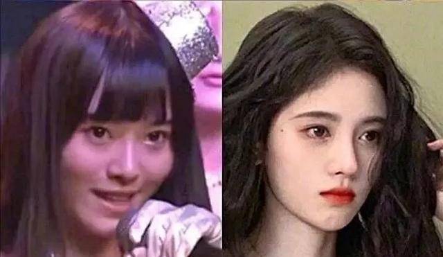 原创女明星整容前后对比最后一位简直就像换了张脸