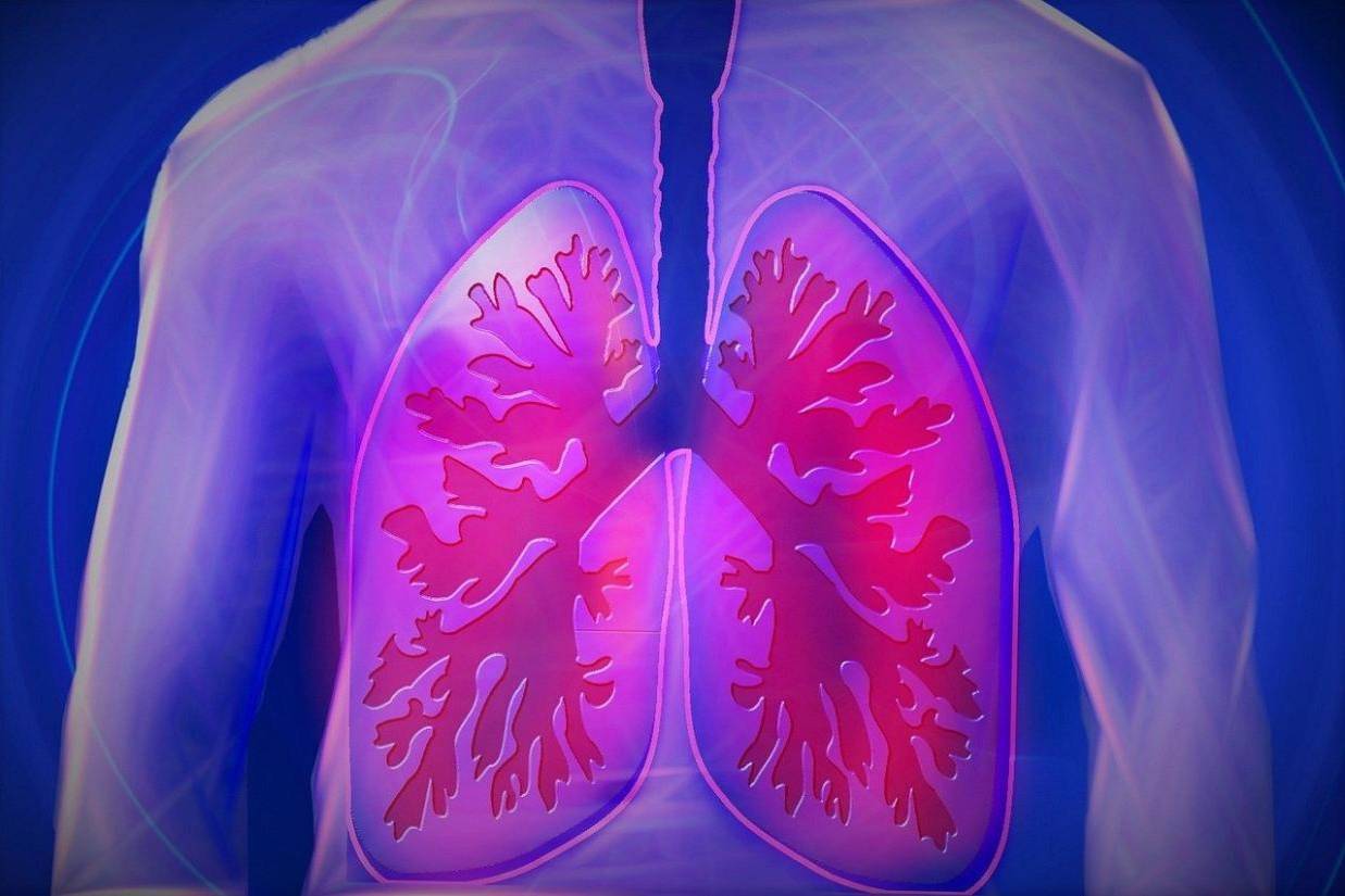 “阳后”CT检查出肺部结节，跟新冠感染有关吗？是不是癌？