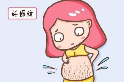 腹部拉皮能不能去除掉妊娠纹？