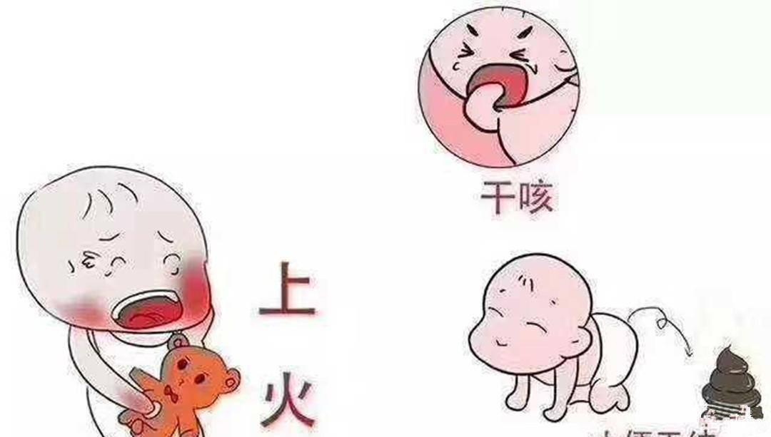 上火分类 中医临床上的上火分为实火和虚火，实火是指体内阳气过旺导致