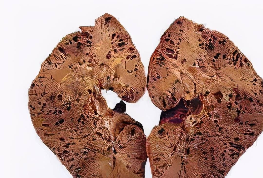 ����֪��˥��ʱ�����Ƿ�͸е����ŵĻ�������ã���أ�