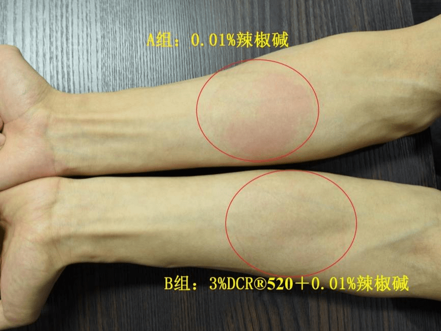 一款纯天然、强效按捺TRPV1的舒缓因子