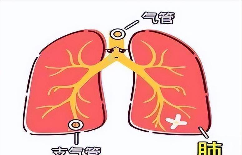 支气管炎常用的三种药物，大家可以根据自己症状选择！