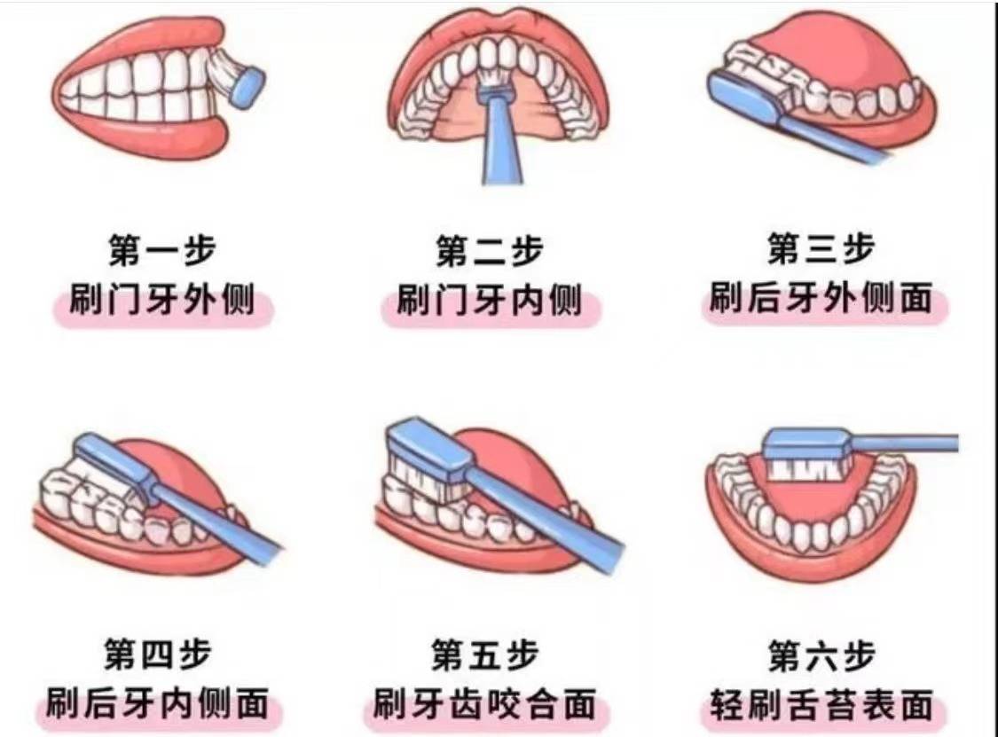 牙结石又硬又臭怎么办？过来人教你三个步调，大片牙石一刷全掉！