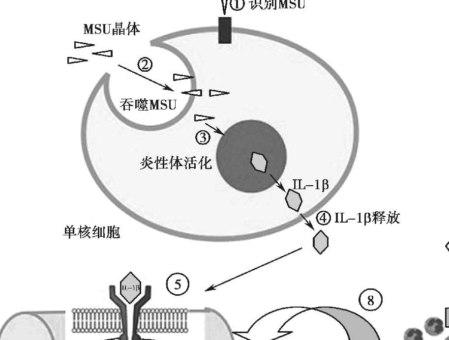 痛风爆发用花椒泡脚？胡椒能降尿酸？痛风不克不及吃辣椒？医生如许说