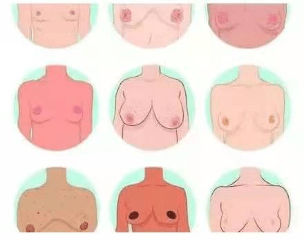 乳晕颜色深就性生活丰富？