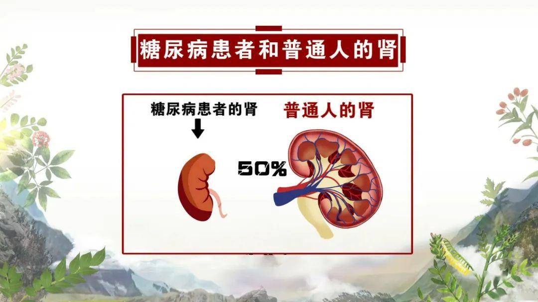 糖尿病肾病:萎缩,被糖腐蚀,肾衰竭