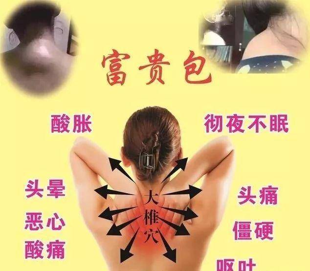 ebe75738c6044abb8ddf81a6c07c8b35.jpeg