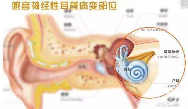 失聪人口_失聪病例单图片(3)