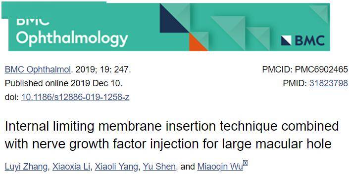 快速恢复视力的药物 050e31232b92435a8ee39721a7601422.jpeg