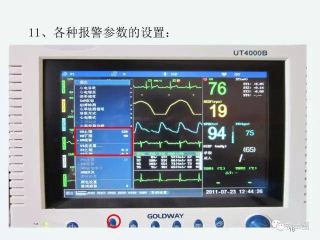 心电监护仪怎么看数值