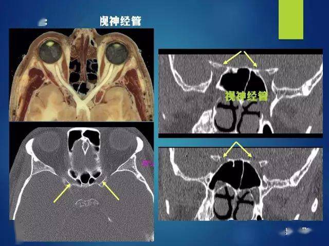 最全的12对颅神经解剖及影像附查体视频