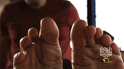 白天上班不能挠,晚上痒的睡不着,  总感觉有无数的小虫子在啃食.