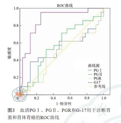 实验研究血清胃蛋白酶原和胃泌素17在胃癌及萎缩性胃炎中的诊断价值