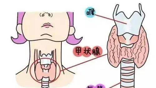 体检查出甲状腺结节该怎么办