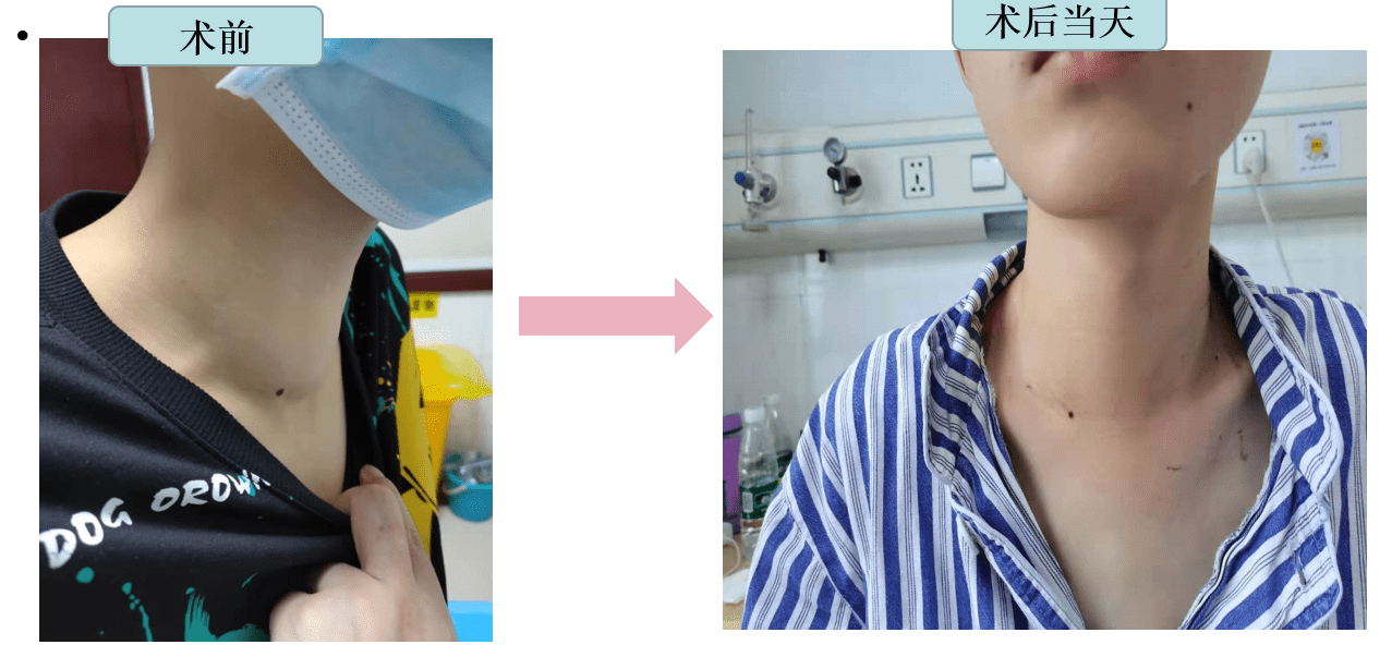 守护你身体里的小蝴蝶甲状腺
