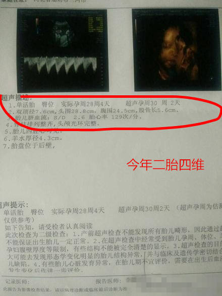 左图,是12年头胎的四维彩超报告单; 右图,是今年二胎四维彩超报告单.