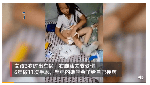 女孩车祸做11次手术学会自己包扎乐观笑容感染众人