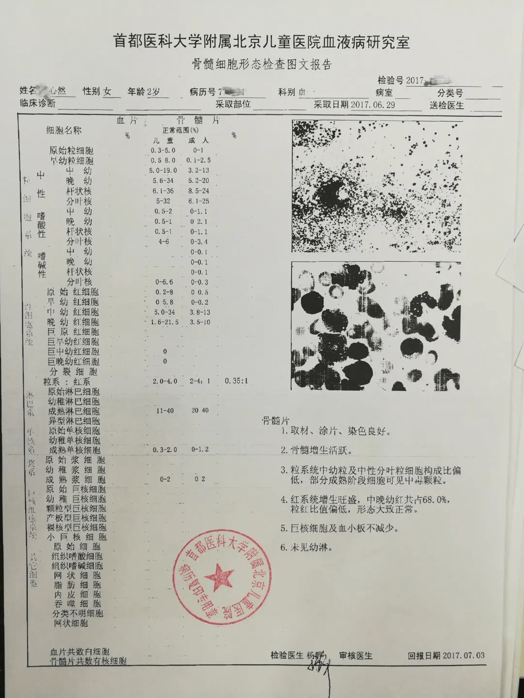 爱佑慈善基金会帮助对抗白血病的小战士回归平凡的快乐生活