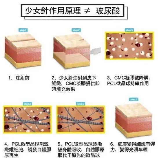 区别是什么?_成分_部位_皮肤