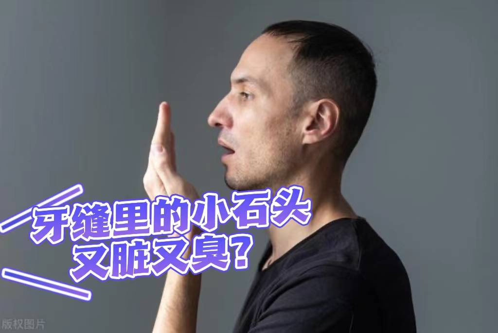 牙缝里的小石头又脏又臭？过来人无偿分享去口气秘笈，万万别错过！