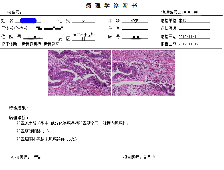 一医青年专家说科普丨肝胆外科郑亦胡:b超发现胆囊腺肌症莫大意!