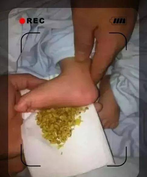 鼻腔|宝宝鼻塞不通气？只要学会这一招搞定！
