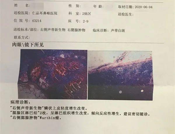 耳后莫名长出肿物,40岁大哥紧急就医确诊"腮腺肿瘤"!