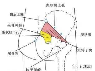 隐约不定地影响到腰,臀部及大腿后侧(不过膝),而臀中肌的痉挛是髂胫束