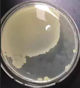 菌落总数检测中常见问题及解答