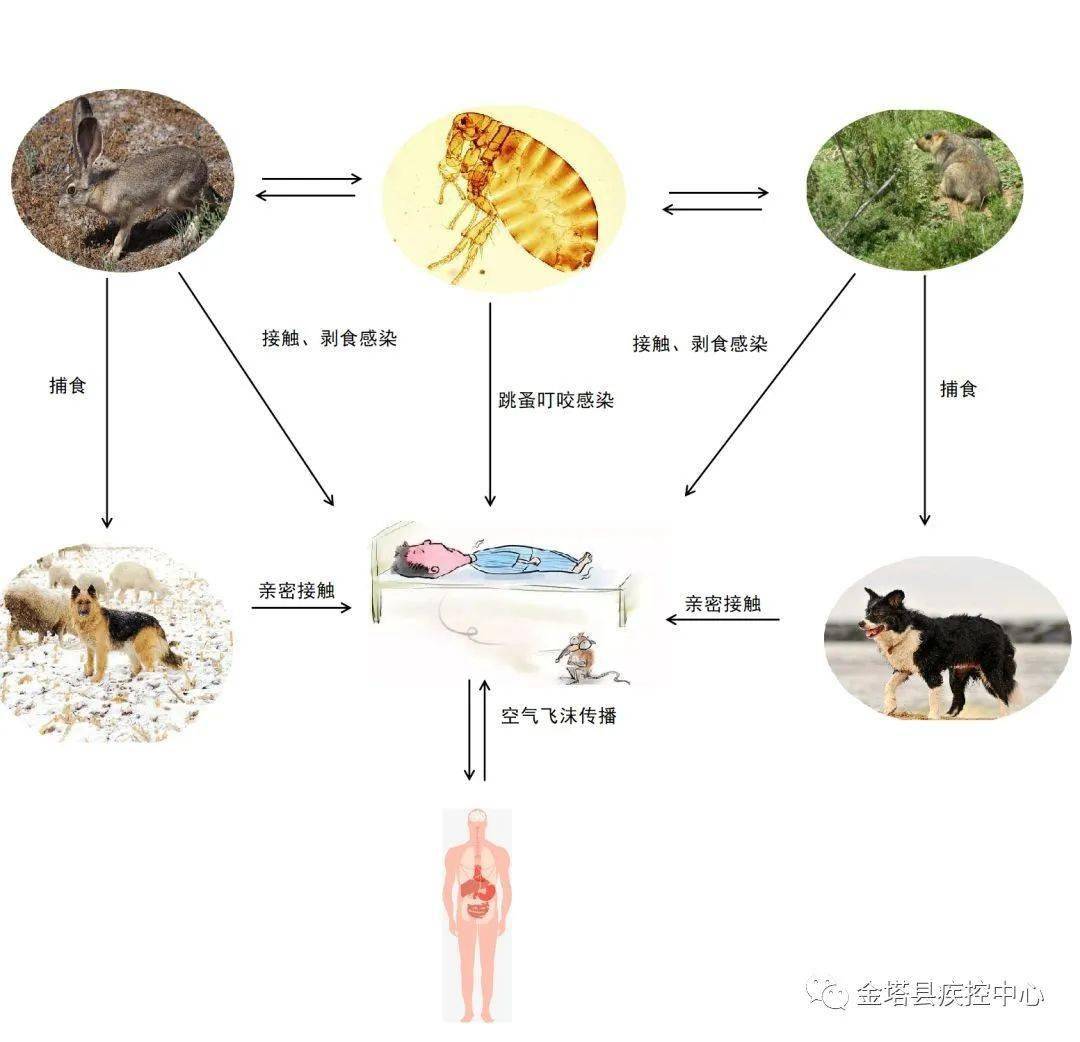 感染鼠疫后会有哪些症状?