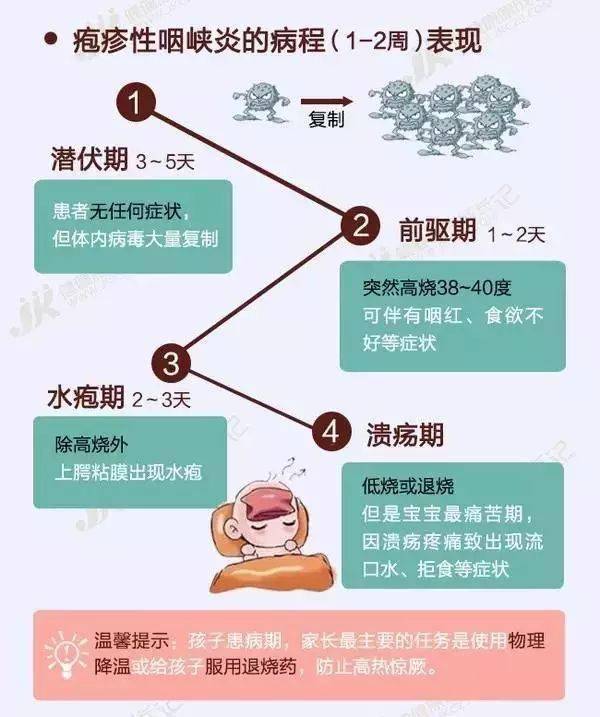 孩子|幼儿疱疹性咽峡炎进入高发期！家里有孩子的一定要注意！