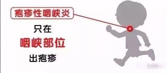 孩子|幼儿疱疹性咽峡炎进入高发期！家里有孩子的一定要注意！