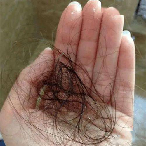 李佳琦推荐的脱发克星!一次就能拯救头屑头痒头油,用了它头发都会跳舞!