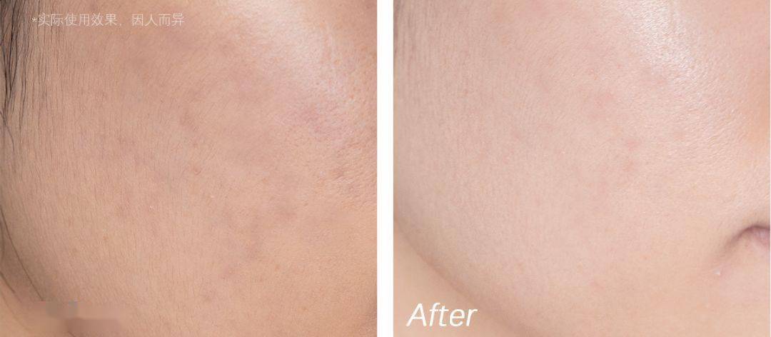 沈梦辰这脸变的!《乘风破浪》这皮肤状态,估计花了不少钱吧?