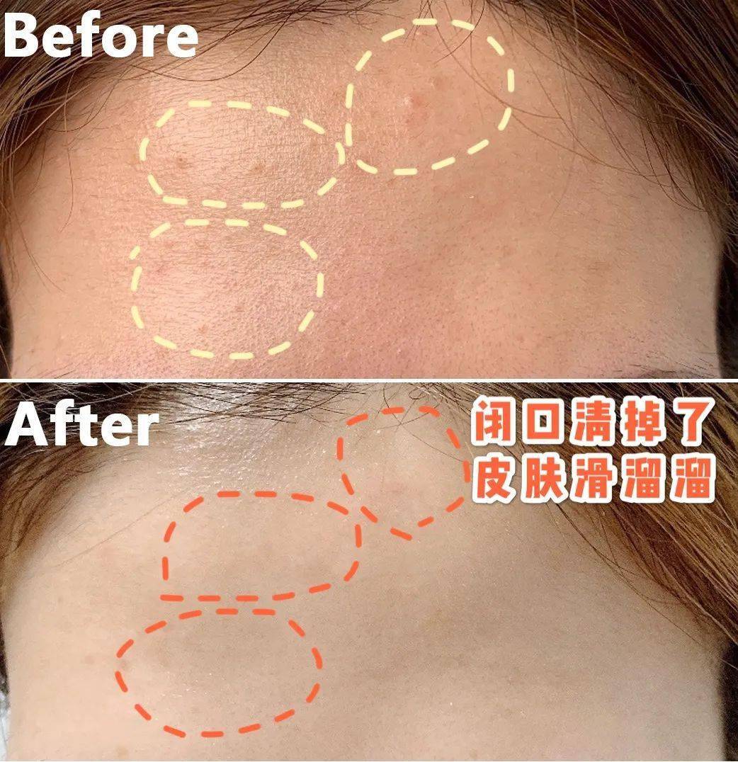 沈梦辰这脸变的!《乘风破浪》这皮肤状态,估计花了不少钱吧?