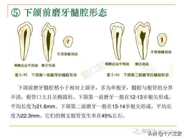 牙体髓腔解剖系统开髓开髓洞型及根管常用器械的认识和使用