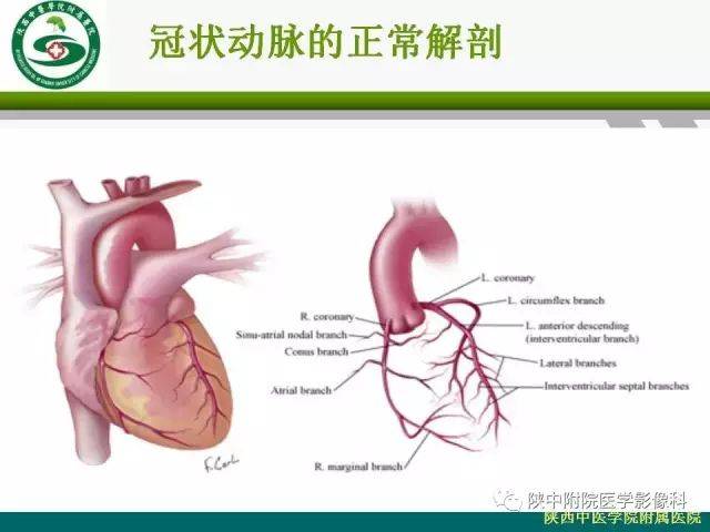 冠脉的正常解剖与变异