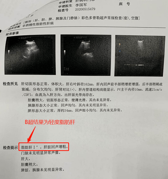 罪魁祸首|深圳11岁男童竟得了重度肝硬化~罪魁祸首是……家长们要注意了~