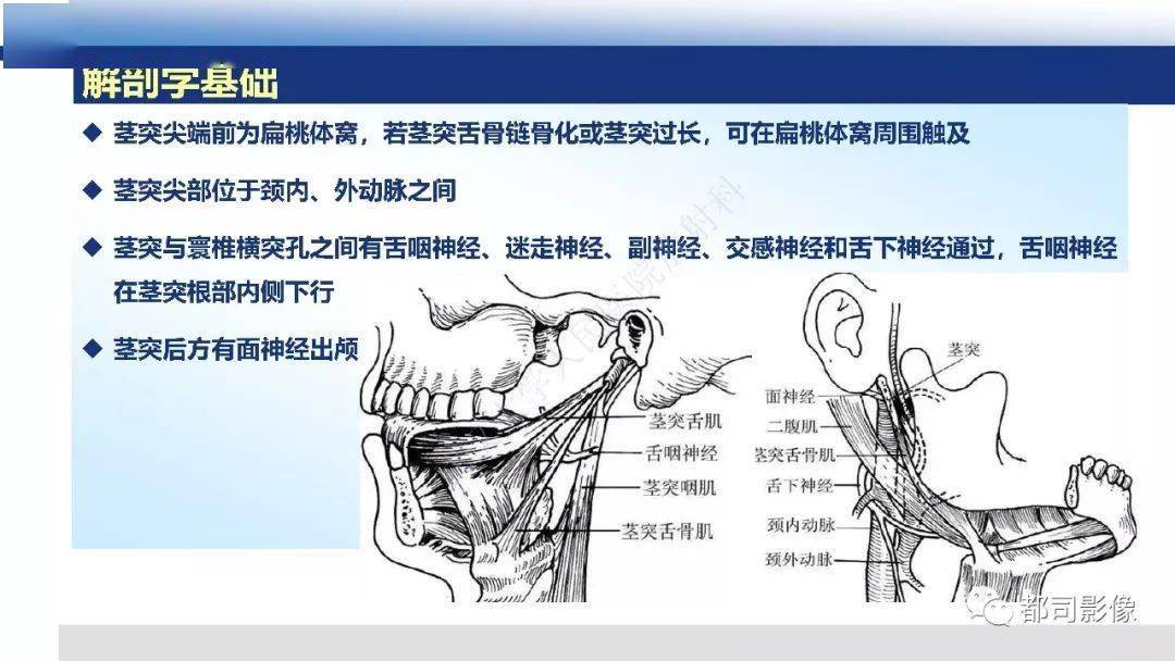 茎突综合征影像诊断