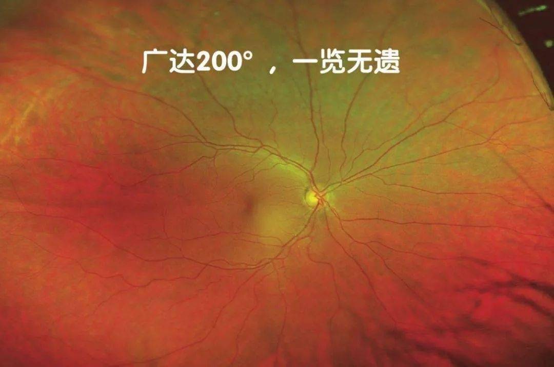 欧堡欧堡眼底检查：一种高精度的眼部检查技术