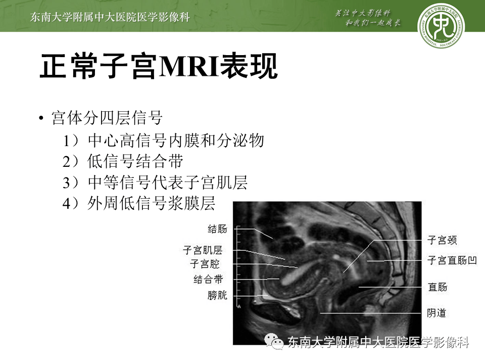 子宫内膜癌mri分期及结构式报告