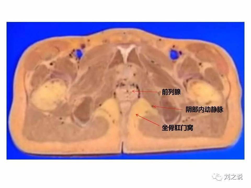 收藏必备:男性盆腔断层解剖