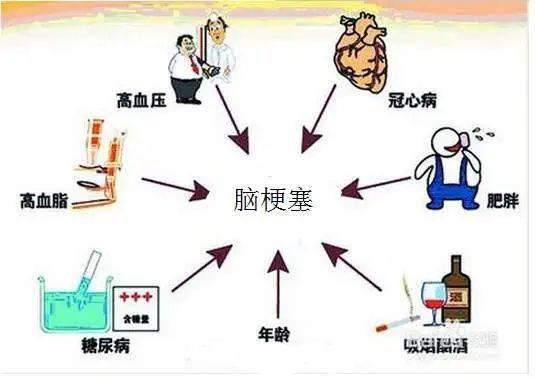 【经验分享】麻醉复苏延迟观察中警惕脑梗