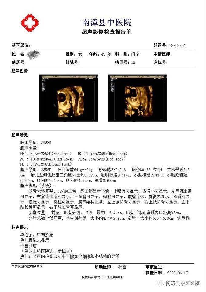 超声检查筛查胎儿畸形那些事儿