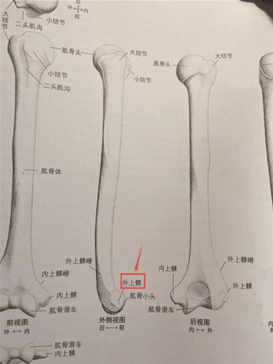 上臂骨折怎么办