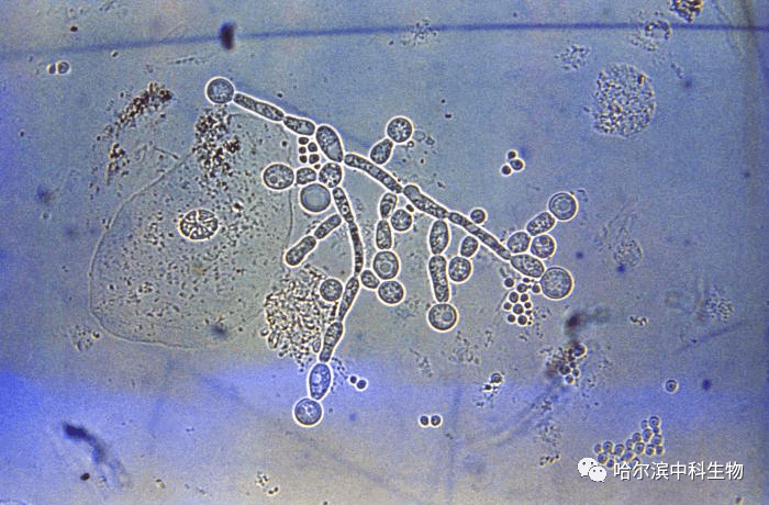 03:白色念珠菌感染(酵母菌)实验室诊断:吉姆萨染色显示非常大的杆状