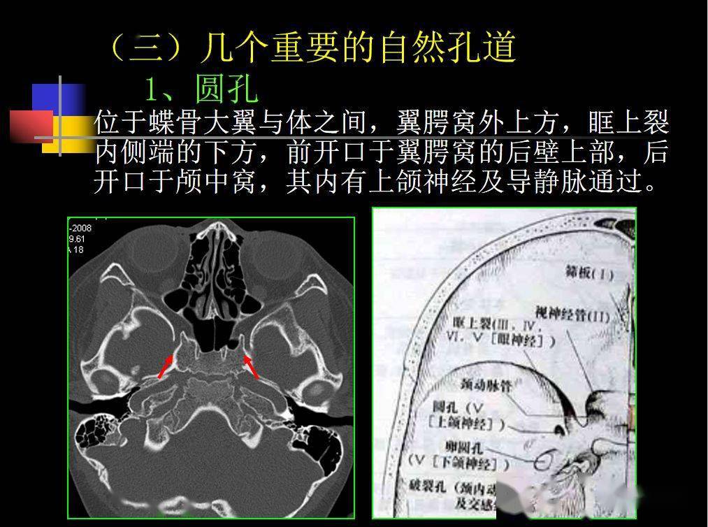 收藏必备 | 鼻咽部的ct详细解剖